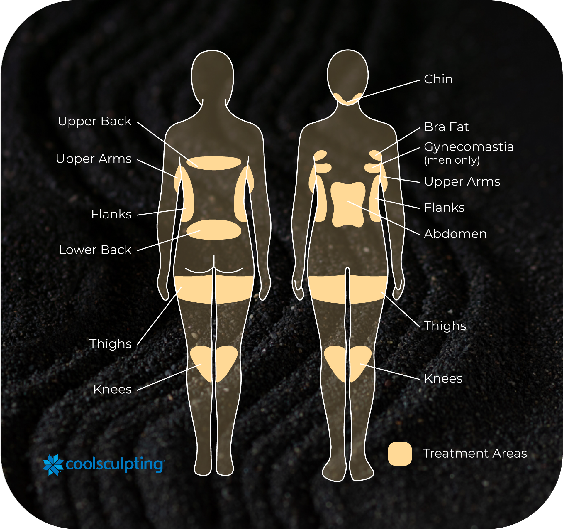 2024 11 Coolsculpting Graphic